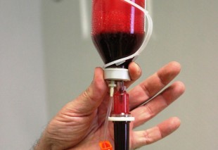Ozone Therapy