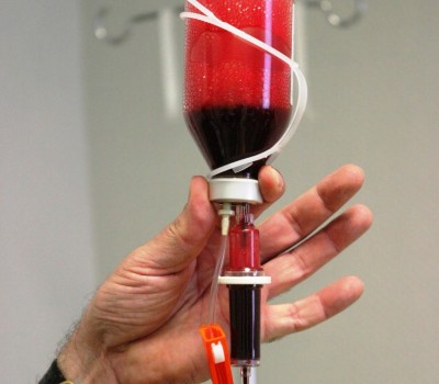 Ozone Therapy